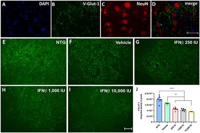 Corrigendum: Neuroprotection by upregulation of the major histocompatibility complex class I (MHC I) in SOD1G93A mice